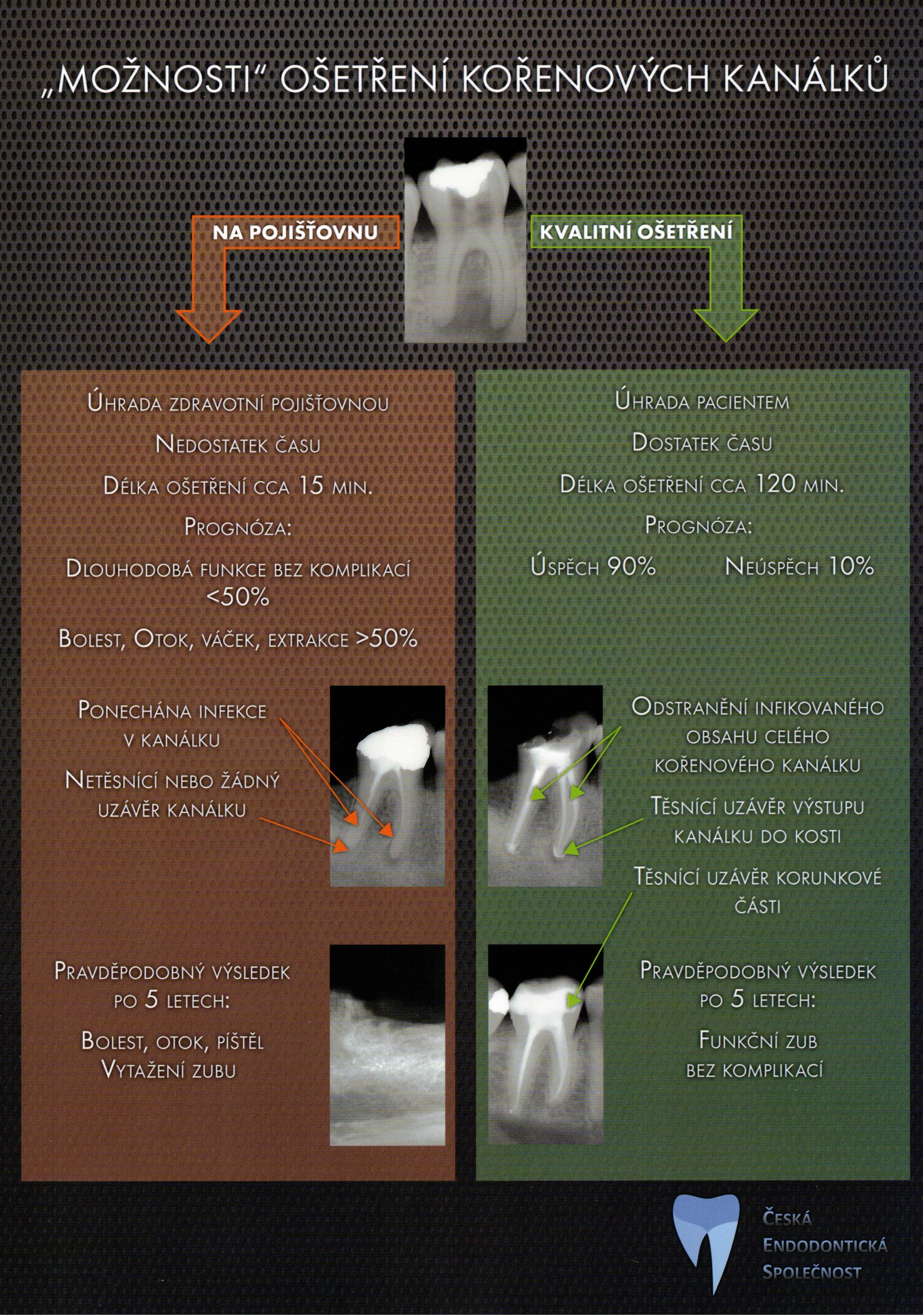 Endodoncie